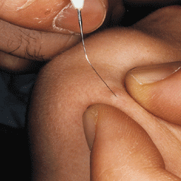 Quale sapone è possibile lavare una faccia da posti